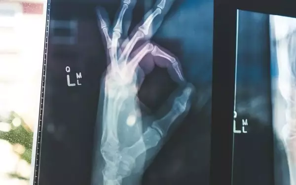 Google's open-source MedGemma AI models are poised to revolutionize healthcare