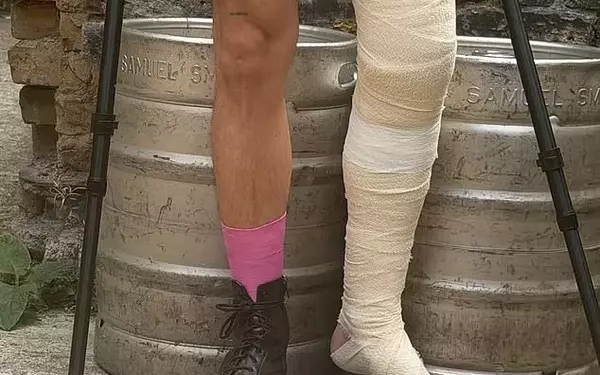Yungblud Continues Tour Despite Severe Leg Injury from Motorbike Crash