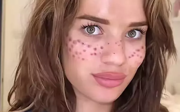 Tilly Whitfield's Journey from TikTok Tattoo Disaster to Freckle Entrepreneurship
