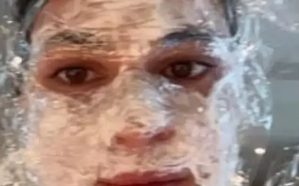 Kylie Jenner's Skincare and Beauty Confessions: Microneedling and Future Plans