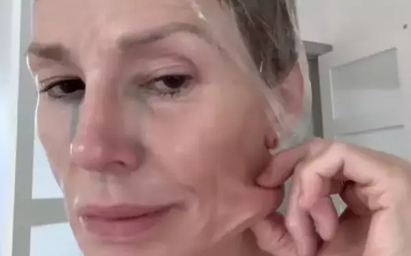 Brandi Glanville's Shocking Health Revelation: 'Something Alive and Moving' in Her Face